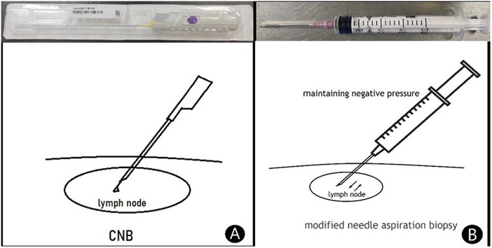 Frontiers | The diagnostic value and safety of modified