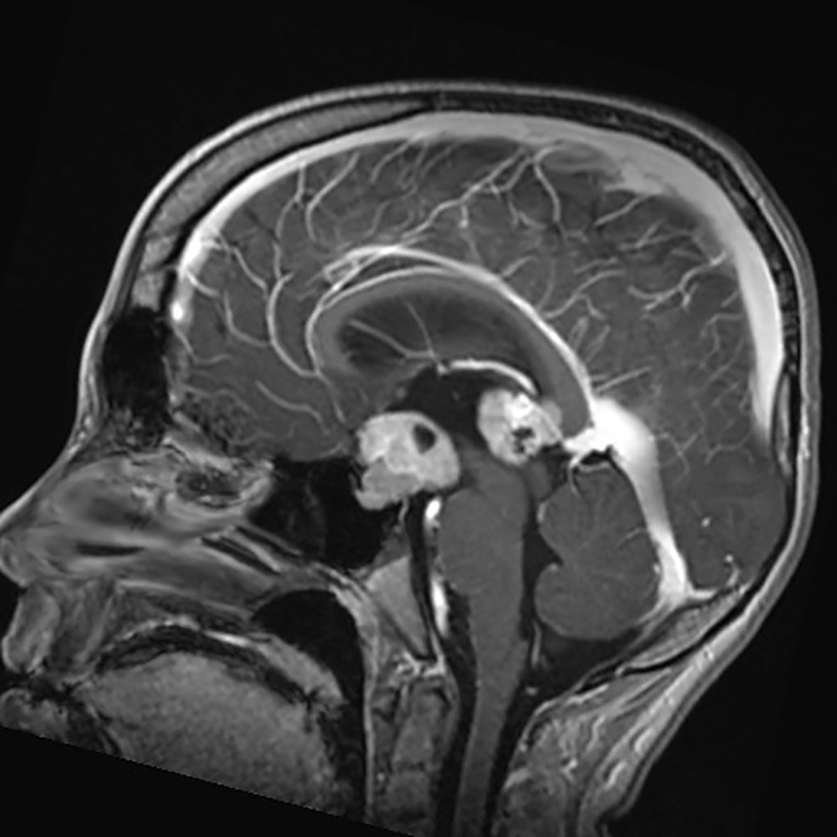 Molecular neuropathology: an essential and evolving toolbox