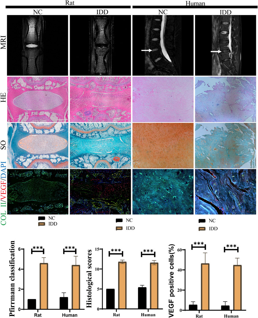 Frontiers Treatment of injectable thermosensitive hydrogel