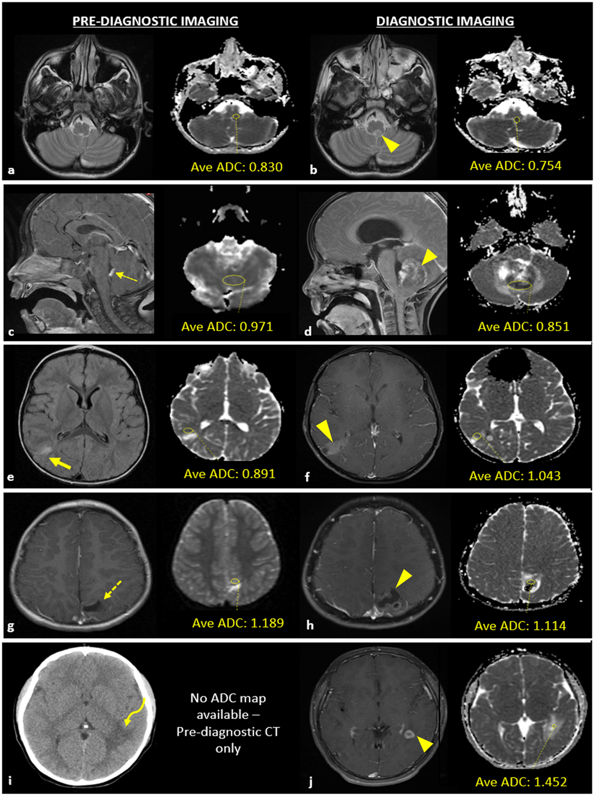Diagnostic Imaging: Brain: 9781931884723: Medicine & Health
