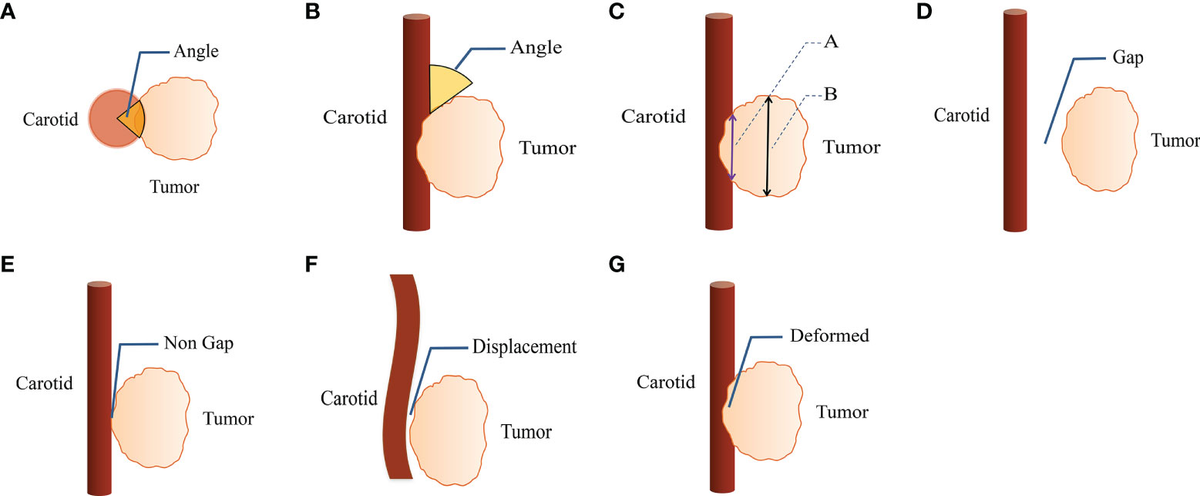 ENCYCLOPAEDIA of OCCLUSION【裁断済】 ENCYCLOPAEDIA of OCCLUSION【裁断済】