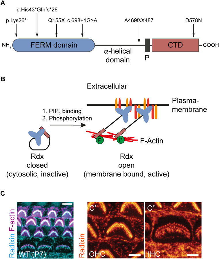 Frontiers | Monoallelic loss of the F-actin-binding protein Frontiers | Monoallelic loss of the F-actin-binding protein