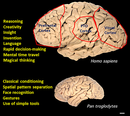 Superior pattern processing in the brain