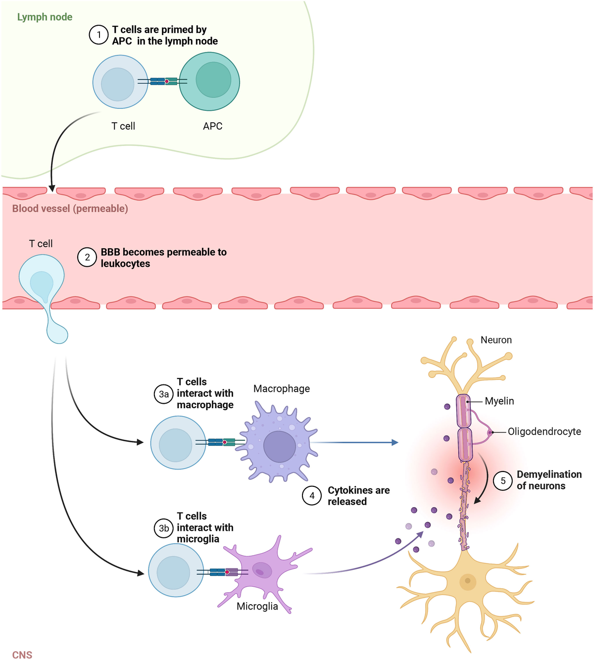 Frontiers Autoreactive lymphocytes in multiple sclerosis  