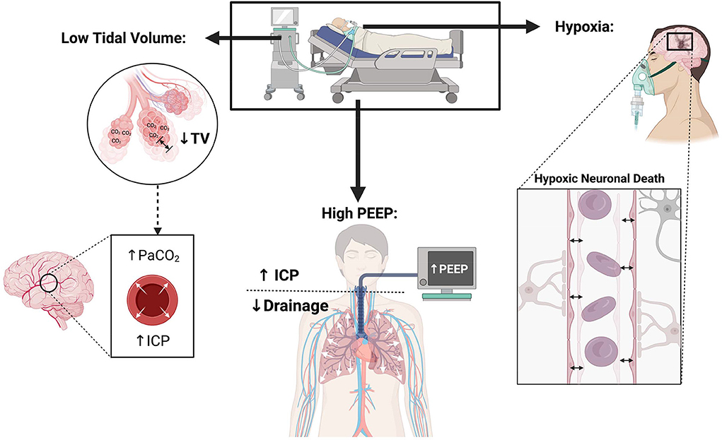 Frontiers Mechanical ventilation in acute brain injury patients with