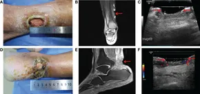 【nabe190様用】ULCER / Grant Us Death hq720.jpg?sqp=-