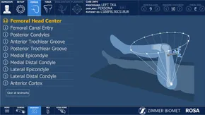 整形外科専門医へのminimal requirements Frontiers | Personalized alignment™ for total knee