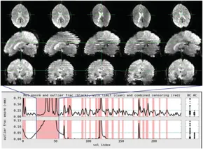 fMRI 原理と実践 fMRI 原理と実践 本