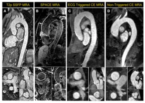 Cardiovascular Magnetic Resonance Imaging (Contemporary