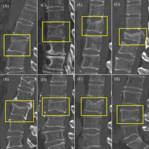 Frontiers | Wearable rehabilitation wristband for distal