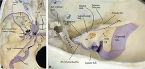 Microsurgical Anatomy and Surgery of the Posterior Cranial Fossa: Surgical Approaches and Procedures Based on Anatomical Study [ハードカバー] Matsushima， Toshio Microsurgical Anatomy and Surgery of the Posterior Cranial