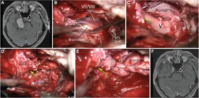 Frontiers | Comprehensive microsurgical anatomy of the Frontiers | Comprehensive microsurgical anatomy of the