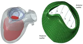 CIRCULATION UpーtoーDate 8ー4―現在と未来をになうCardiologistのための 進化した3Dイメージング 後編 超音波検査の見 [大型本] NHK WORLDにて、心臓シミュレーター「ped UT-heart」の開発