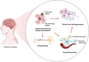 RETEN A new perspective on Alzheimer's disease: m6A ... - Frontiers fgene-14-1166831-g001.jpg RETEN A new perspective on Alzheimer's disease: m6A ... - Frontiers fgene-14-1166831-g001.jpg