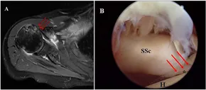 健康・医学 MRI ARTHROSCOPY and SURGICAL ANATOMY Mri, Arthroscopy, and Surgical Anatomy of the Joints