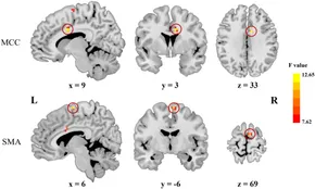 Age-related deterioration of performance and increase of