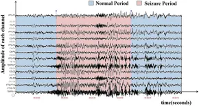 eeg 2012年 Developmental trajectories of EEG aperiodic and periodic