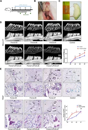 その他 h High-glucose-associated YTHDC1 lactylation reduces the