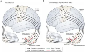 RETEN A neurocomputational view of the effects of Parkinson's ... - Frontiers fnhum-18-1383714-g001.jpg RETEN A neurocomputational view of the effects of Parkinson's ... - Frontiers fnhum-18-1383714-g001.jpg
