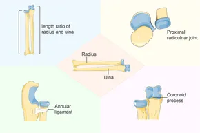 CABEZA DE ARTICULACION What do we need to address when we treat neglected ... - Frontiers fped-12-1430549-g001.jpg CABEZA DE ARTICULACION What do we need to address when we treat neglected ... - Frontiers fped-12-1430549-g001.jpg