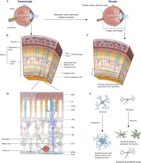 【初回限定】 Frontiers | understanding current myopia: in glia Retinal パンツ