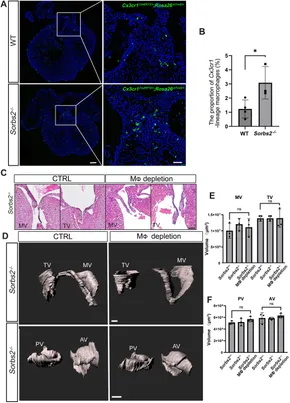 Frontiers | Increased cardiac macrophages in Sorbs2-deficient