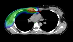 Frontiers | Baseline cross-sectional imaging of locally