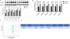 Colorectal Cancer in the Elderly [ハードカバー] Tan， Kok-Yang RANK promotes colorectal cancer migration and invasion by