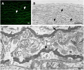 おかもと様 Frontiers | Calcification of the elastic component: the