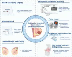 健康・医学 Radiotherapy Techniques in Breast Cancer Master Breast Radiation Planning: Simple Guide for Radiation