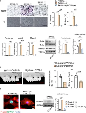 Frontiers | Piezo1 protects against inflammatory bone loss