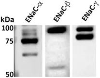 fimmu-08-00842-g001.jpg