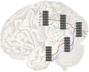 Frontiers | Computational Neuropsychology and Bayesian Inference