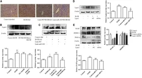 Frontiers | miR-203 Inhibits Alcohol-Induced Hepatic