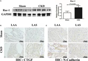 Frontiers | Chronic Kidney Disease Increases Atrial Fibrillation