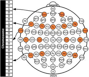 eeg 2007年 The interictal EEG recording shows high amplitude spike-wave