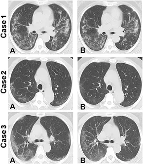 CORONA(コロナ)CDH-1818 pic_lineup_wh03.png