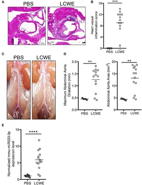 mmiiikiiiページ Cardiac 123I-mIBG Imaging in Heart Failure