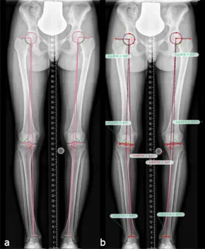 希少　UPPER AND LOWER EXTREMITIES 洋書 fendo-12-754084-g001.jpg
