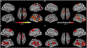 専用　9セット ライブディオZX リアスポイラー一式 ZXスポイラーをAF27スーパーディオ