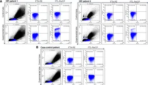 EXTRACTOR Ferritin Light Chain: A Candidate Autoantigen in Immuno ... - Frontiers fimmu-13-851096-g005.jpg EXTRACTOR Ferritin Light Chain: A Candidate Autoantigen in Immuno ... - Frontiers fimmu-13-851096-g005.jpg