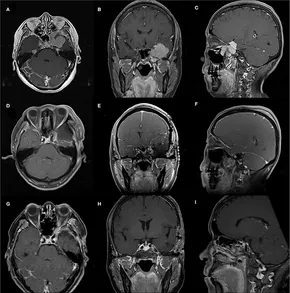 【激安通販 オンラインショップ】 fneur-13-855973-g001.jpg 健康・医学
