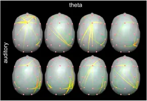 eeg 2011年 fnetp-04-1425625-g001.jpg