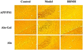 Frontiers | Prominent Effects of Berbamine Hydrochloride on