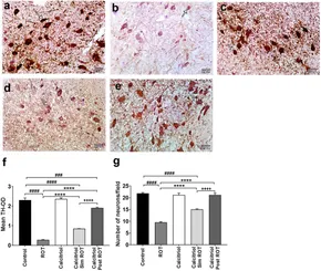 Frontiers | Neuroprotective and therapeutic effects of