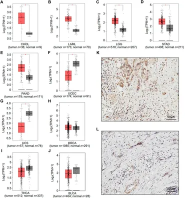 Frontiers | High expression of RNF169 is associated with