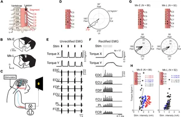 Ethanol Elevates Excitability of Superior Cervical Ganglion
