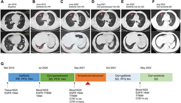 健康・医学 Thoracic Tumours 健康・医学 Thoracic Tumours WHO Classification of Tumours