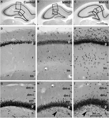Frontiers | Gestational and early postnatal hypothyroidism