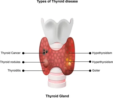 Thyroid Cancer Explore vol.1 no.2(2015 「Thyroid Cancer Expl Next-Generation Molecular Imaging of Thyroid Cancer